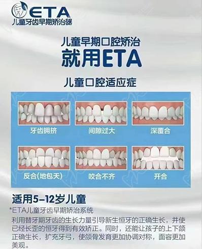 儿童牙齿早期矫正ETA简介