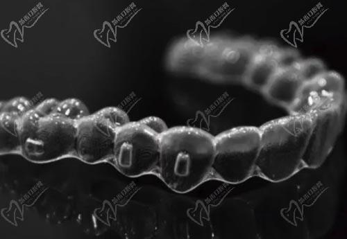 牙齿隐形矫正器 牙齿隐形矫正器