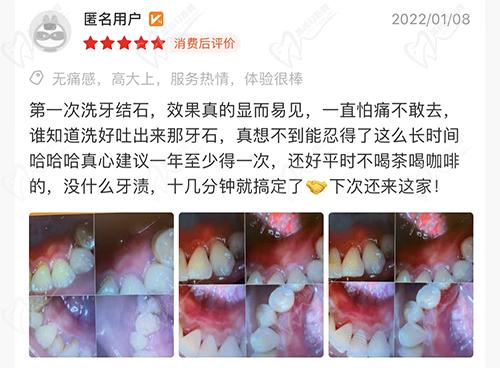 广东揭阳牙博士口腔评价
