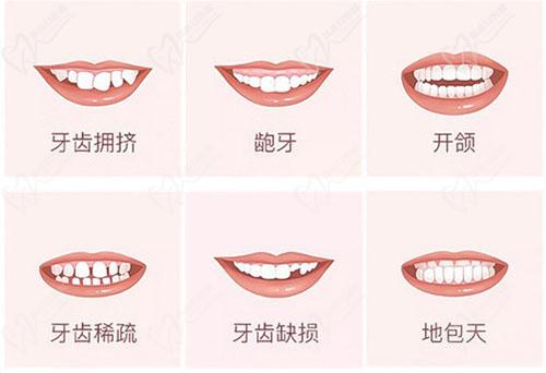 汕头德瑞口腔正畸 汕头德瑞口腔正畸