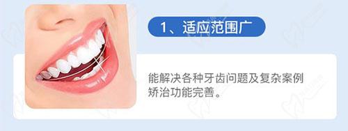 汕头德瑞口腔金属矫正优势 汕头德瑞口腔金属矫正优势