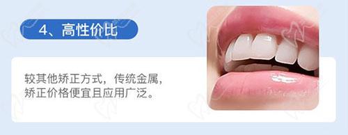 汕头德瑞口腔金属矫正优势 汕头德瑞口腔金属矫正优势