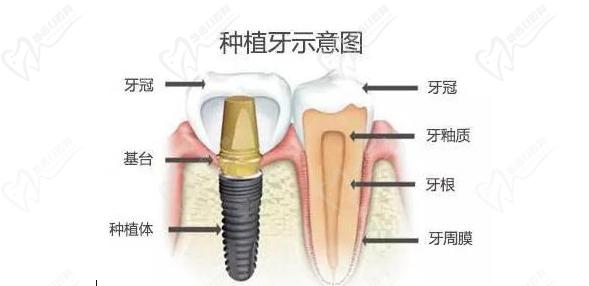 张岩-西安牙动力口腔诊所-医师