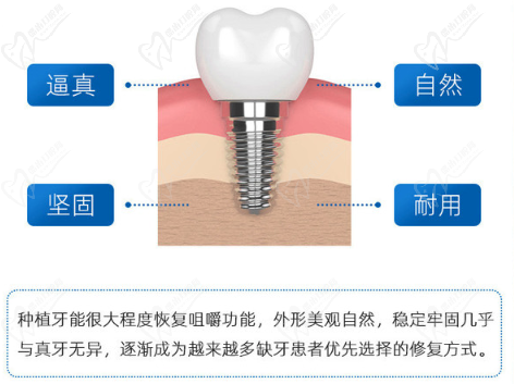长沙美奥口腔医院韩国奥齿泰种植牙优势
