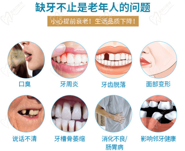 长沙美奥口腔医院种植牙适应症