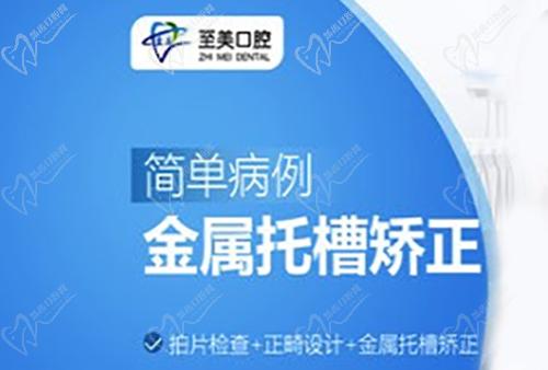 张家口至美口腔金属托槽矫正