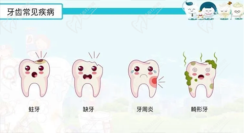 牙齿常见疾病
