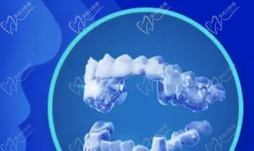 正雅GS版和经典版区别