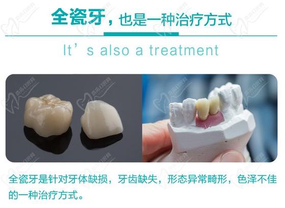 晋江青阳金榜口腔进口威兰德全瓷牙