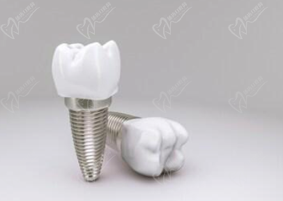 缺牙常用的修复方法
