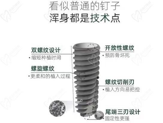 美国皓圣种植牙都有什么特点