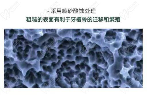 美国种植牙有什么不同之处