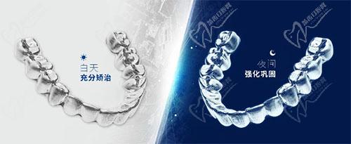 正雅隐形矫正优势