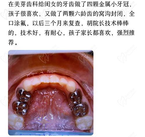 唐山美芽齿科评价