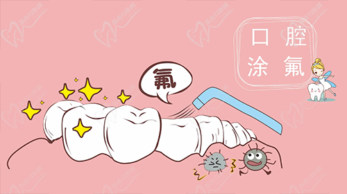 口腔涂氟