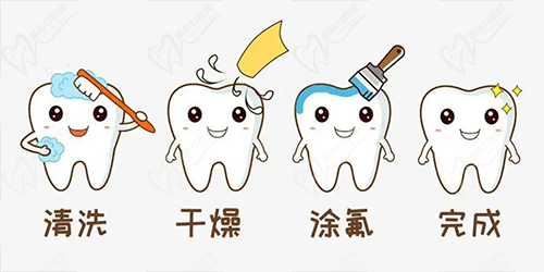 口腔涂氟流程