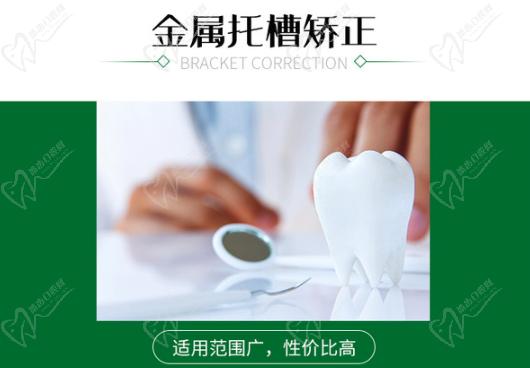 金属托槽矫治器技术优势
