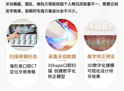 牙齿矫正方案设计