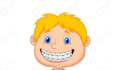 儿童牙齿矫正
