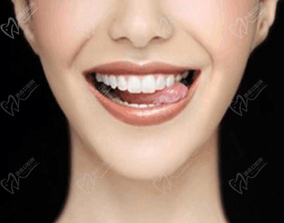 于海霞让您笑出自信美