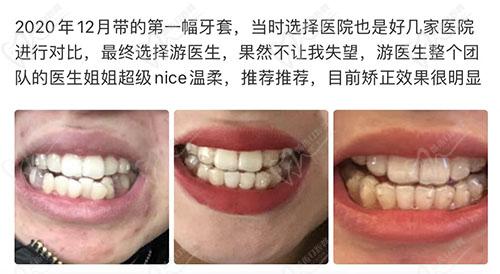 游学敏医生点评