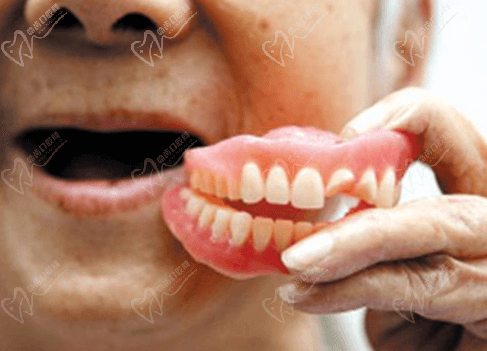 牙齿缺失半口种植