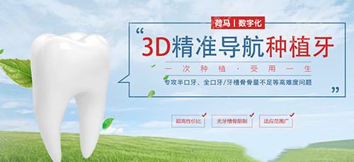 数字化种植