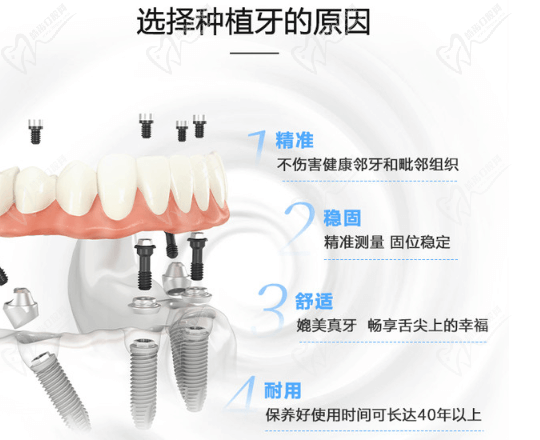 厦门思迈尔口腔韩国奥齿泰种植牙优势