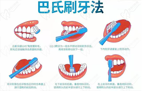 巴氏刷牙法