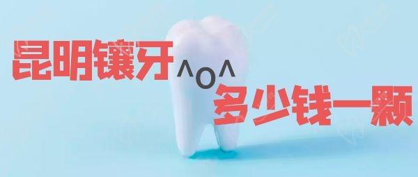 昆明镶牙多少钱一颗 昆明镶牙多少钱一颗