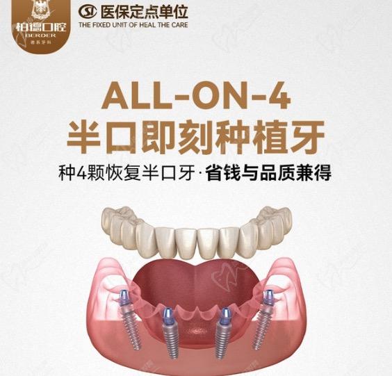 广州柏德口腔ALL-ON-4半口种植牙