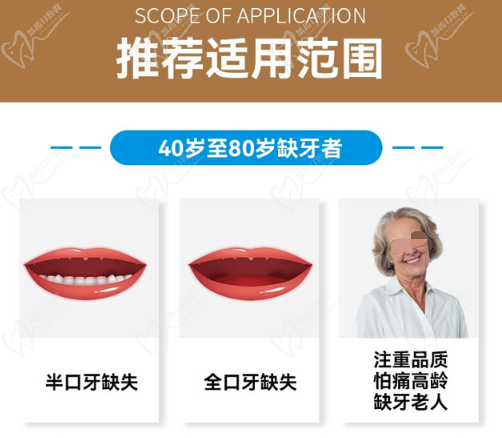 广州柏德口腔ALL-ON-4半口种植牙适用范围