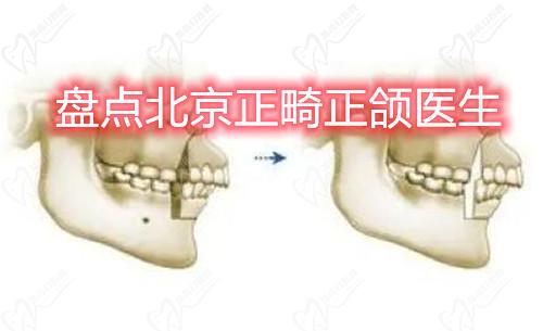 北京正畸正颌医生名单