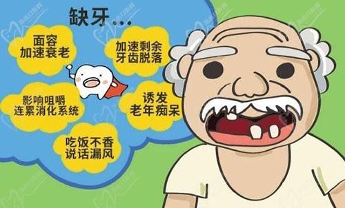 缺牙危害你知道吗