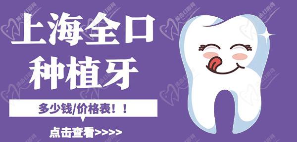 上海全口种植牙收费价目表