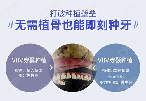 徐州医大鼎植口腔穿颧穿翼种植术