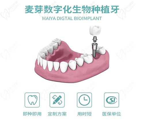 惠州麦芽口腔数字化种植牙