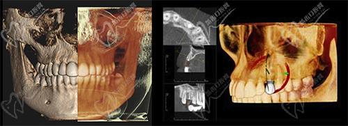 惠州麦芽口腔正畸优势