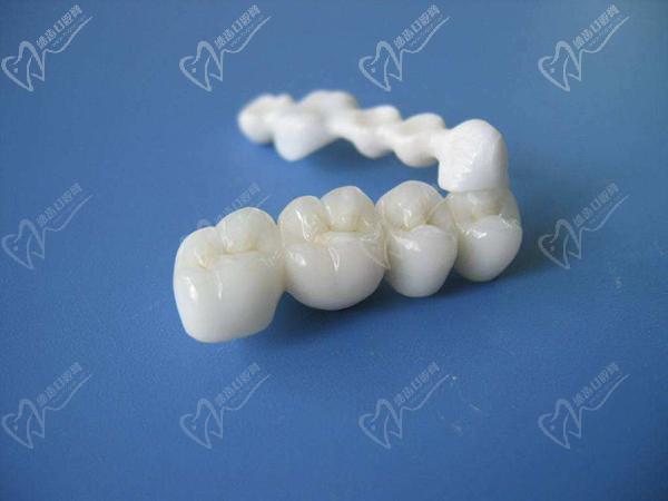 做全瓷牙基牙早晚会烂掉吗