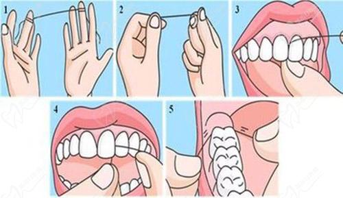 牙线使用方法