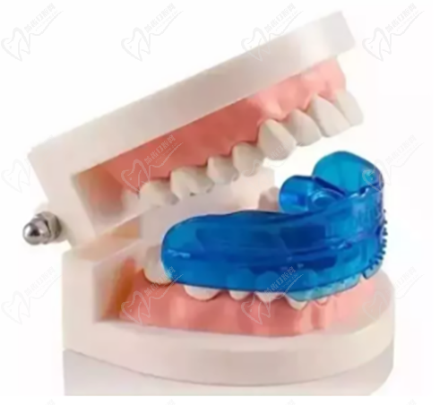 乳牙反颌矫正器