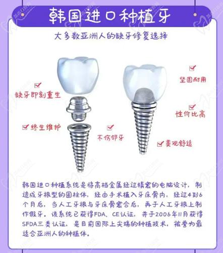 韩国进口种植牙