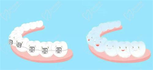 杭州雅莱口腔牙齿矫正技术过硬