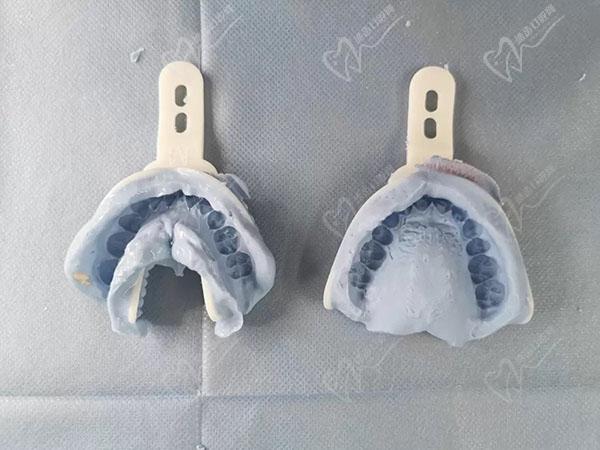 鼎植医生集团正畸评价