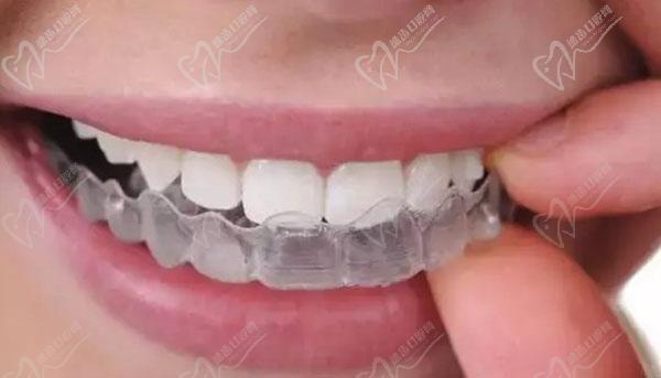 上海鼎植口腔高春菊正畸怎么样