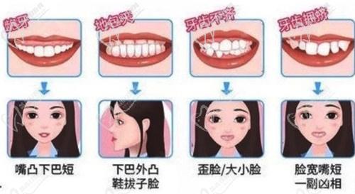 时代天使隐形矫正