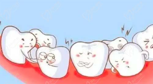 牙齿畸形