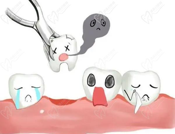 拔牙tips⎮拔牙后为什么不能吐口水？拔牙后多久可以种植牙合适呢