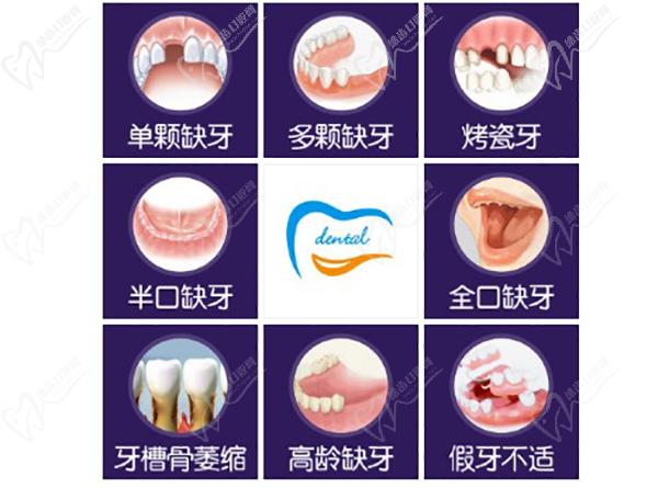 北京中诺口腔医院立得用微创种植牙适用以下人群