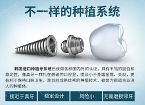 韩国进口种植牙优势 韩国进口种植牙优势